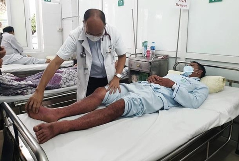 sốt xuất huyết - Ảnh 2.
