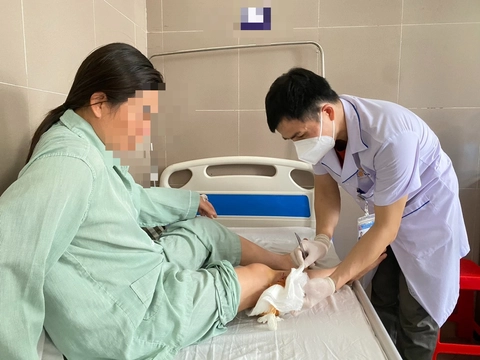 Chó cắn nhập viện tăng gấp 4 lần: Cảnh báo mùa hè dễ phát bệnh dại - Ảnh 1. Một bệnh viện tiếp nhận 20 bệnh nhân bị chó cắn trong 1 tháng - Ảnh 1.