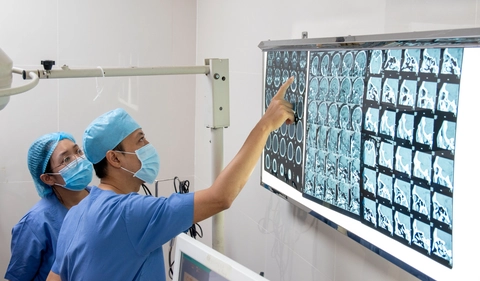 Hàng xóm dùng đũa nhựa đâm vào mắt, nhãn cầu phải của bệnh nhân bị biến dạng nặng - Ảnh 1.