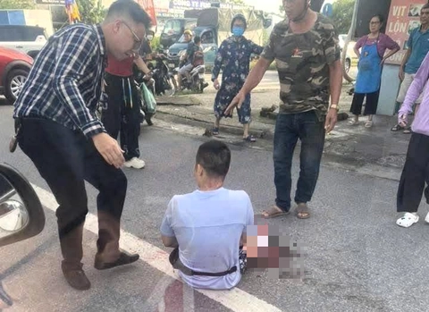 Một Tiktoker bị chém gần đứt lìa bàn tay - Ảnh 1.