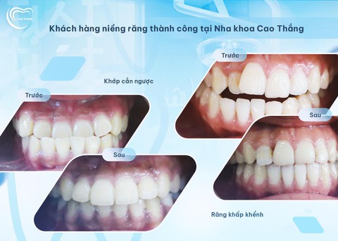 Nha khoa Cao Thắng - Ảnh 4.