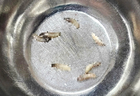 con giòi - Ảnh 2.