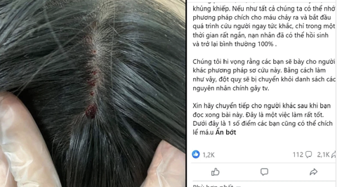 đột quỵ - Ảnh 1.