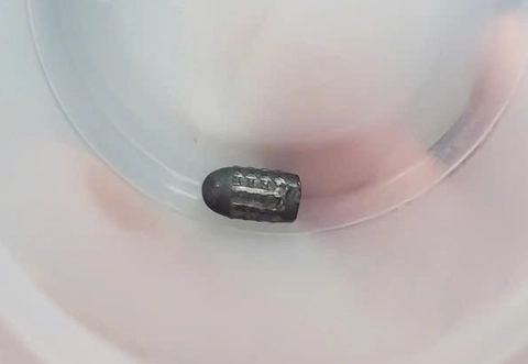 Đã tìm ra người bắn súng hơi khiến đạn lạc trúng đầu người phụ nữ làm vườn - Ảnh 1.