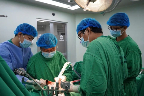dao mổ siêu âm - Ảnh 1.