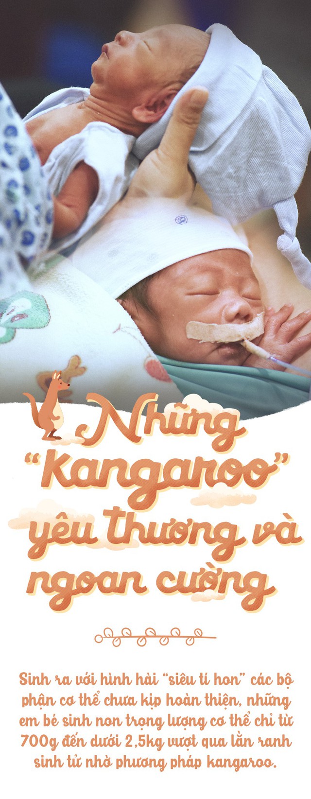 Những đứa bé 'kangaroo'