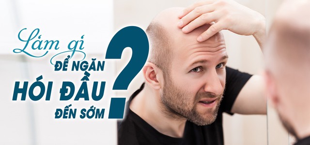 Làm gì để ngăn hói đầu đến sớm?