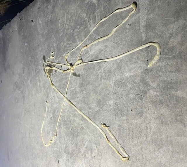 Nearly 10m pork tapeworm found parasitizing man in northern Vietnam - Ảnh 2.