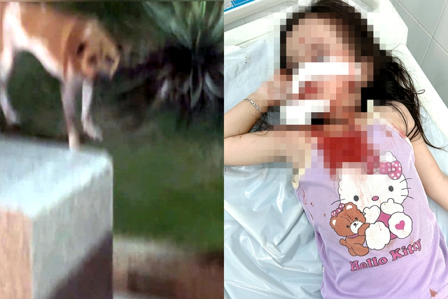 4-year-old girl mauled by loose dog at coastal square in Ho Chi Minh City - Ảnh 1.