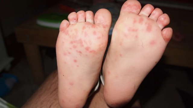 Vietnam ramps up response to COVID-19, dengue, HFMD with national campaign - Ảnh 1.