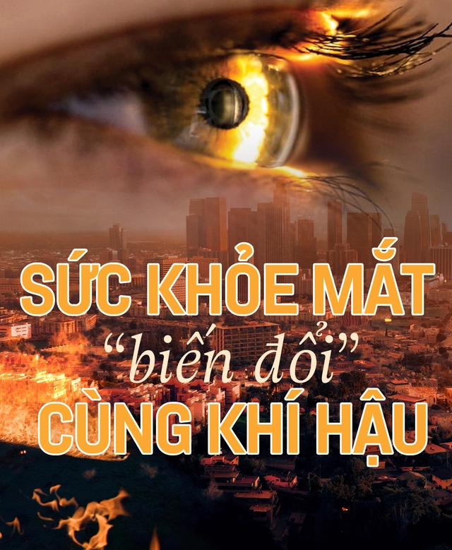 Sức khỏe mắt 'biến đổi' cùng khí hậu