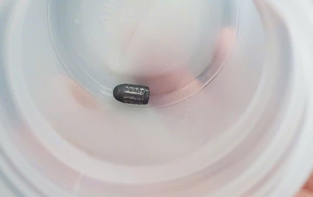 Vietnamese woman survives stray bullet to head while gardening- Ảnh 2.