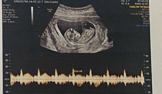 In Vietnam, revealing fetal sex is illegal except in these cases- Ảnh 1.