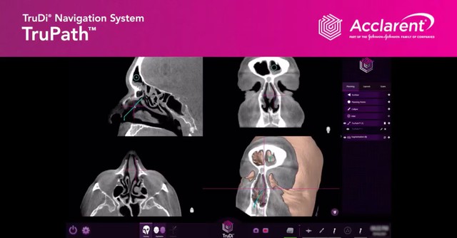 As AI enters the operating room, reports arise of botched surgeries and misidentified body parts- Ảnh 3.