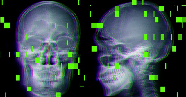 As AI enters the operating room, reports arise of botched surgeries and misidentified body parts- Ảnh 1.