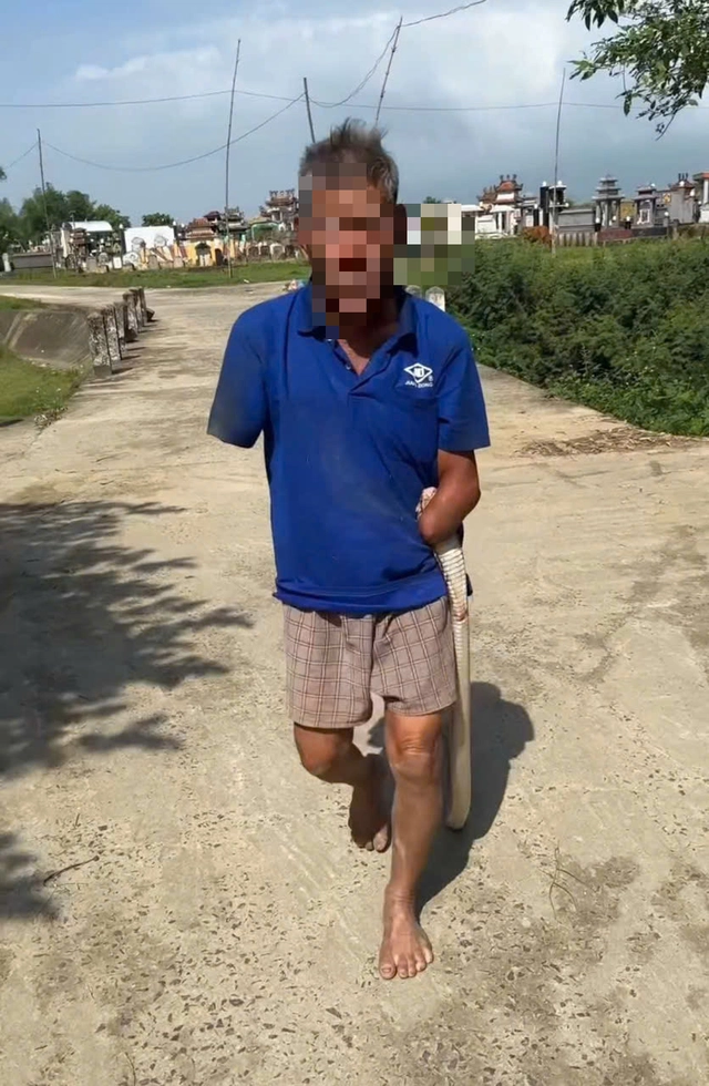 In Vietnam, elderly man bitten by cobra carries snake home before hospital treatment- Ảnh 1. In Vietnam, elderly man bitten by cobra carries snake home before hospital treatment- Ảnh 1.