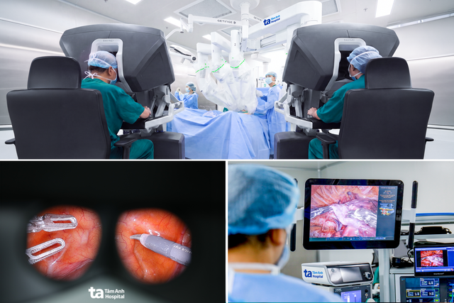 Vietnamese doctors perform country's first robotic cancer surgery using two US surgical robots - Ảnh 1.