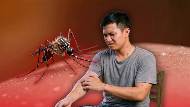 Không phải nhóm máu hay màu da, đâu là ‘bí mật' thực sự khiến MUỖI thường đốt một số người? - Ảnh 1.