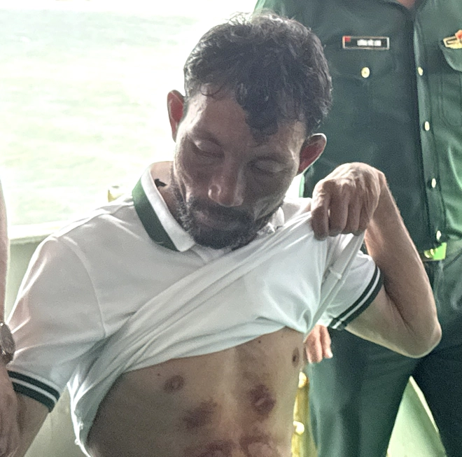 Vietnam fisherman survives 96 hours adrift at sea: "I thought of my 2 children"- Ảnh 3.