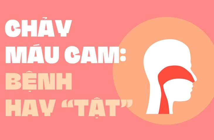 Liệu pháp tự nhiên phòng chữa chứng chảy máu mũi tại nhà - Ảnh 3.