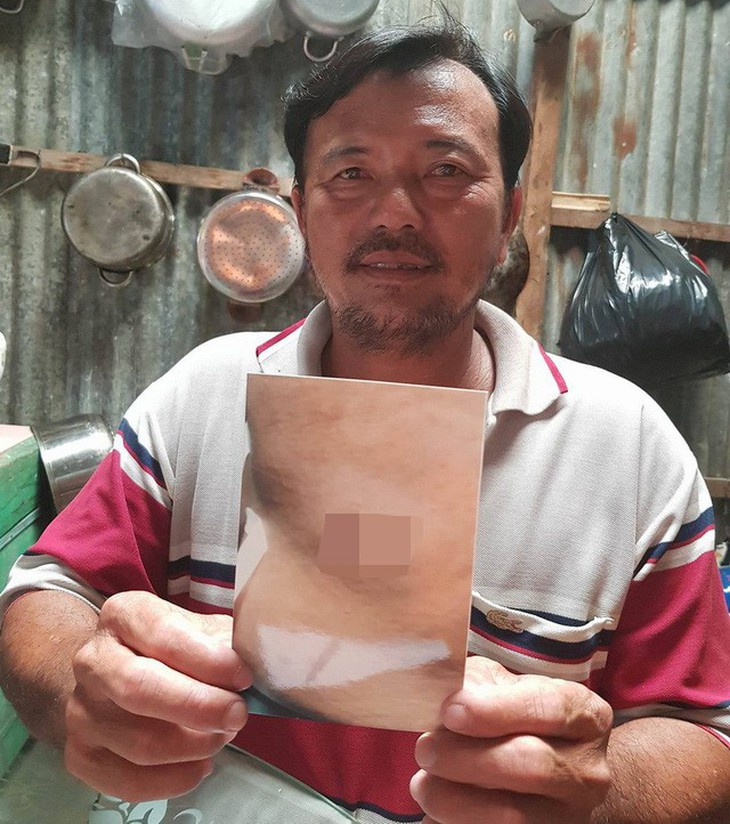 Không xử lý cán bộ bắn dân vì nạn nhân chưa kiện - Ảnh 1. Không xử lý cán bộ bắn dân vì nạn nhân chưa kiện - Ảnh 1.