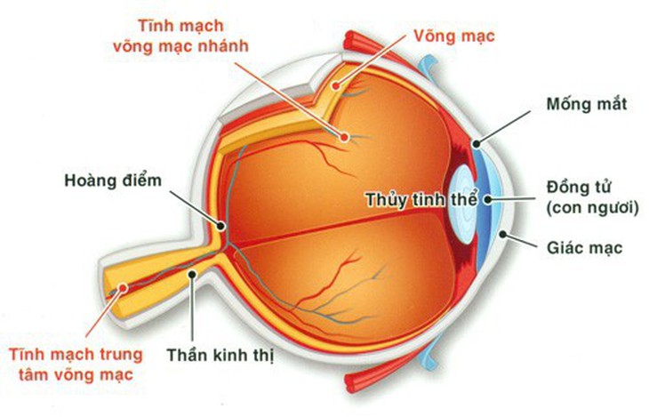 Bệnh lý tắc tĩnh mạch võng mạc gây mất thị lực - Ảnh 1.