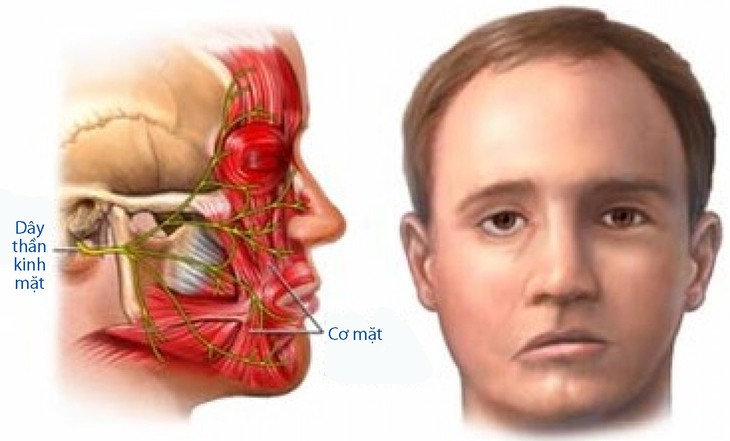 Co giật nửa mặt - Ảnh 1.