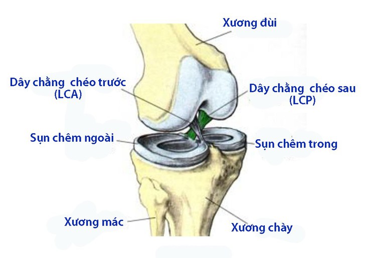 Đứt dây chằng chéo sau: Khi nào cần phẫu thuật? - Ảnh 1.