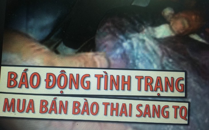 Bộ Công an chỉ đạo tăng cường đấu tranh tội phạm mua bán bào thai