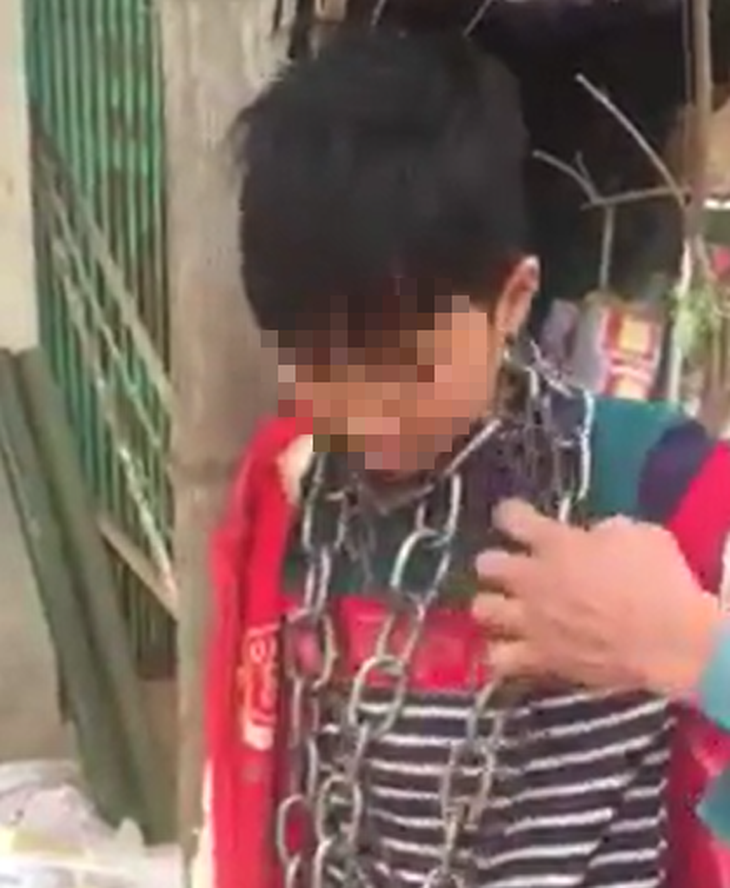 Chú ruột đeo xích vào cổ cháu trai bị phạt cảnh cáo - Ảnh 1. Chú ruột đeo xích vào cổ cháu trai bị phạt cảnh cáo - Ảnh 1.