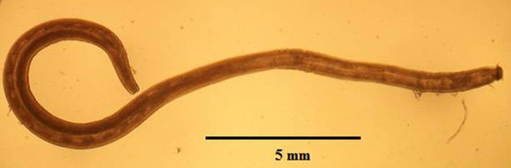 Đau đầu, nôn ói, rối loạn tiền đình vì giun não - Ảnh 2.