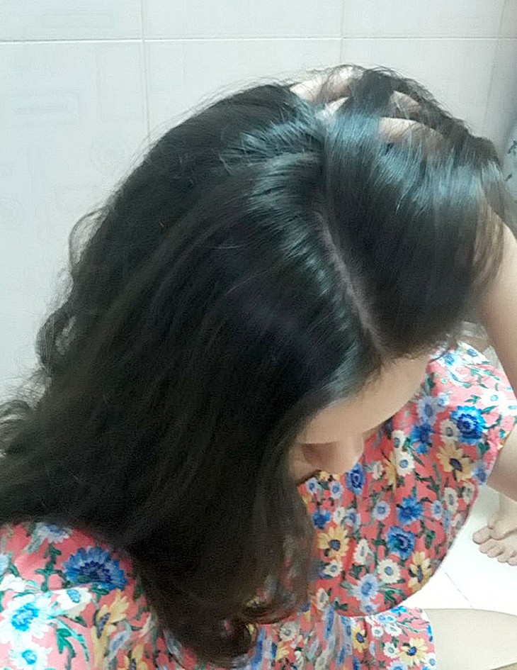 Tóc phản ánh sức khỏe - Ảnh 1. Tóc phản ánh sức khỏe - Ảnh 1.