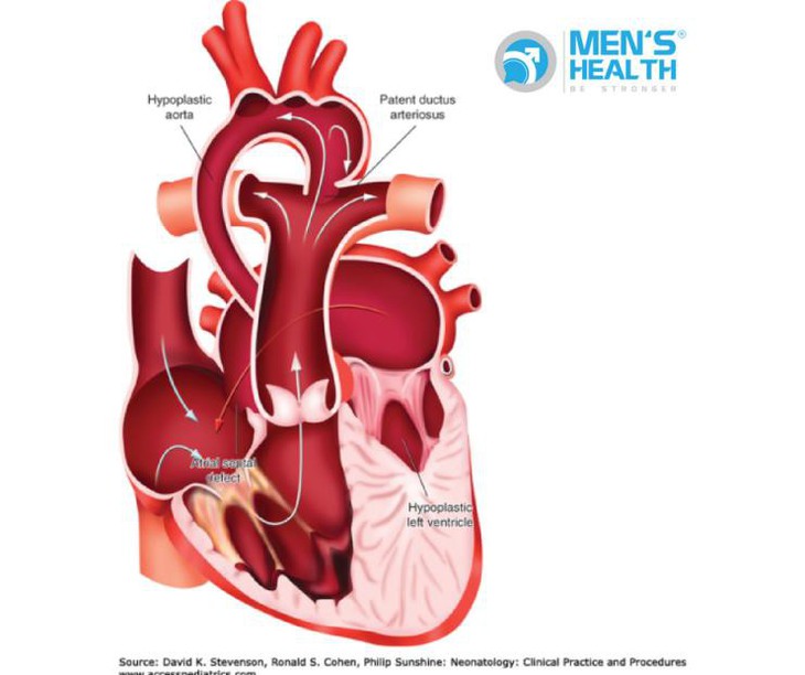 Biểu hiện thường gặp ở trẻ bị bệnh tim bẩm sinh và cách điều trị. - Ảnh 4.