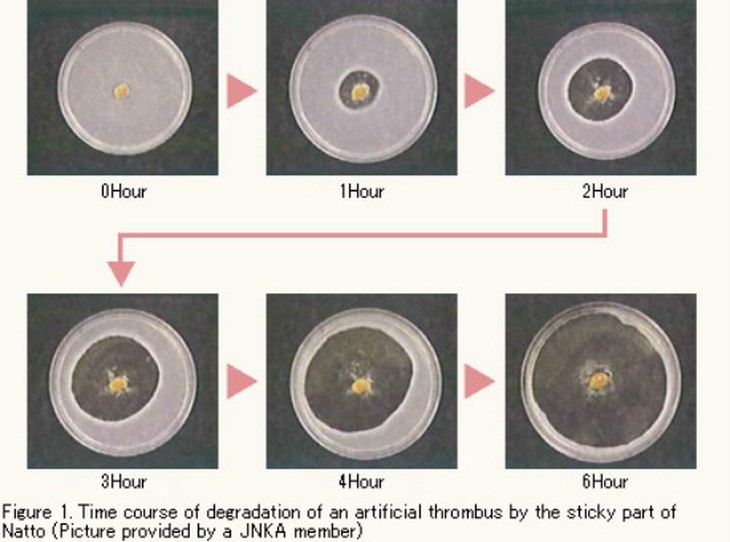 NattoEnzym làm tan cục máu đông thế nào? - Ảnh 3.
