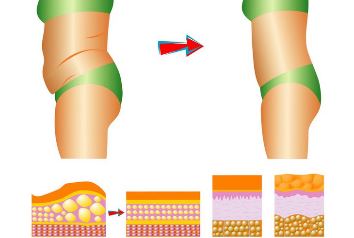 Bí quyết đơn giản để giảm mỡ bụng tại nhà - Ảnh 1.