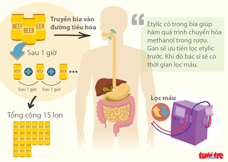 Truyền 15 lon bia vào cơ thể để… cứu bệnh nhân ngộ độc rượu - Ảnh 2.