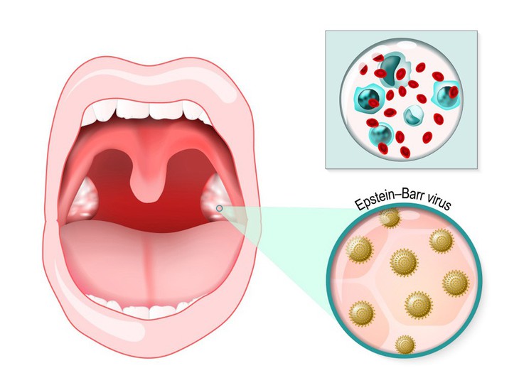 Căn bệnh của những nụ hôn - Ảnh 1. Căn bệnh của những nụ hôn - Ảnh 1.