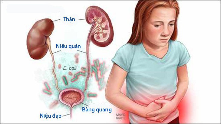 Chăm sóc trẻ bị nhiễm khuẩn tiết niệu - Ảnh 1.