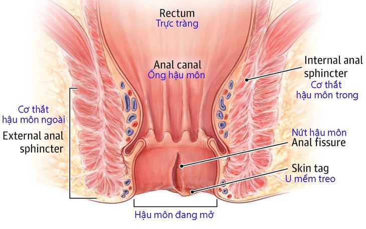 Đau hậu môn và nhiễm trùng hậu môn - Ảnh 1.