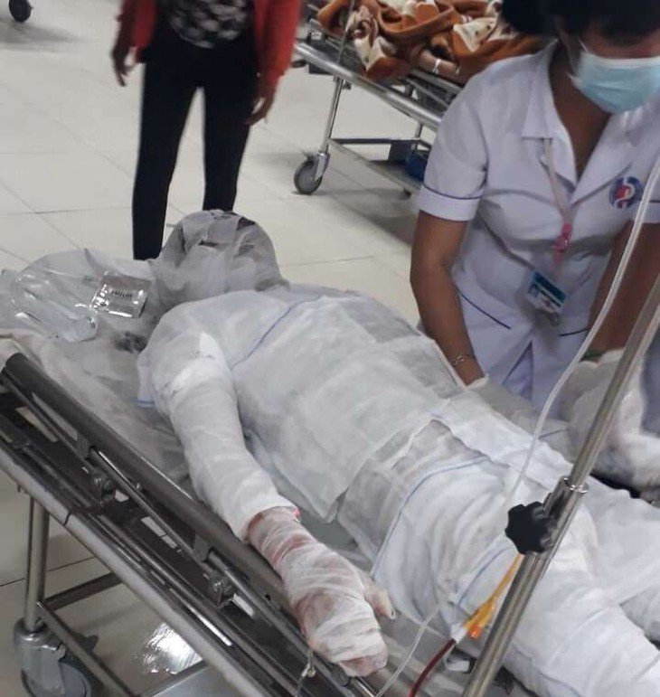 Nổ và cháy trong khu công nghiệp, 1 người chết, 3 người bị thương - Ảnh 2. Nổ và cháy trong khu công nghiệp, 1 người chết, 3 người bị thương - Ảnh 2.