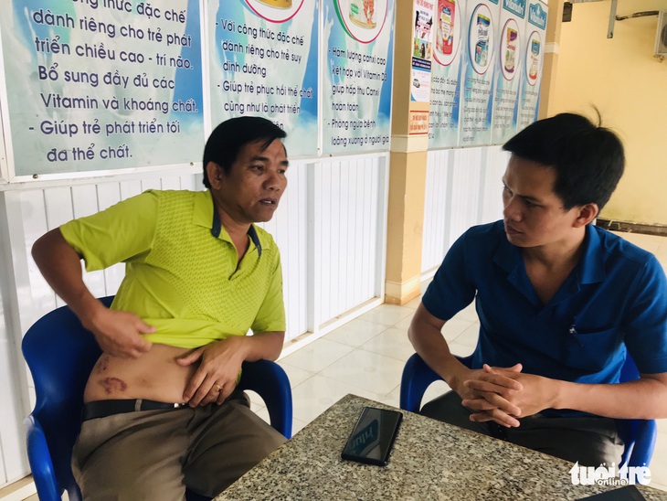 Chánh văn phòng huyện ủy nhậu về uýnh bầm dập tài xế chở mình - Ảnh 2. Chánh văn phòng huyện ủy nhậu về uýnh bầm dập tài xế chở mình - Ảnh 2.