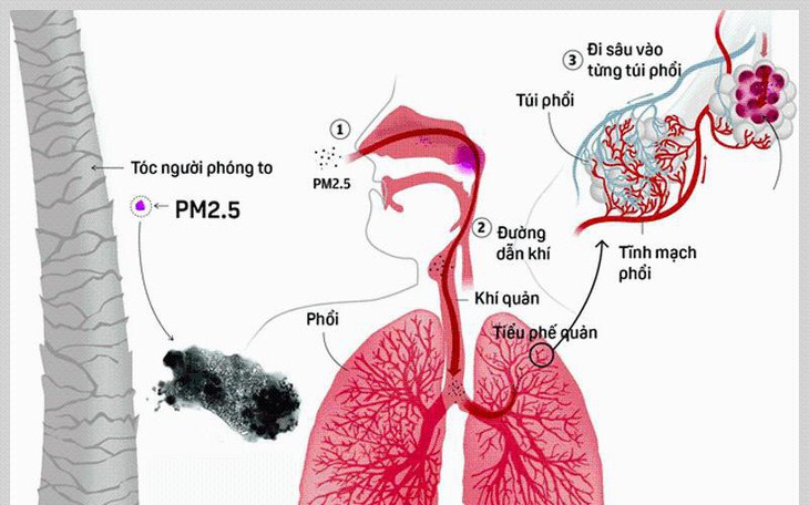 Tác hại khôn lường từ ô nhiễm không khí đến sức khỏe