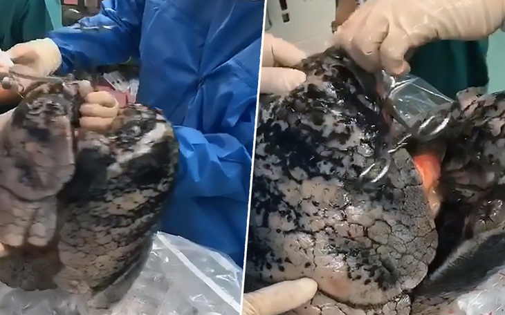 Tỉ lệ tử vong do sốc thuốc tại Mỹ giảm từ năm 2023, bị xuyên tạc là thành tựu chính quyền Trump - Ảnh 3.