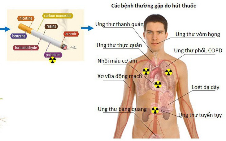 Chất phóng xạ trong thuốc lá gây nguy hiểm