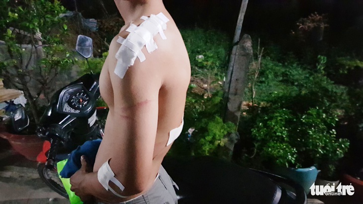 Một thanh niên có dấu hiệu tâm thần, đâm người dân bị thương - Ảnh 2. Một thanh niên có dấu hiệu tâm thần, đâm người dân bị thương - Ảnh 2.