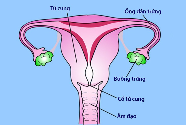 Viêm vùng chậu ở phụ nữ - Ảnh 1. Viêm vùng chậu ở phụ nữ - Ảnh 1.