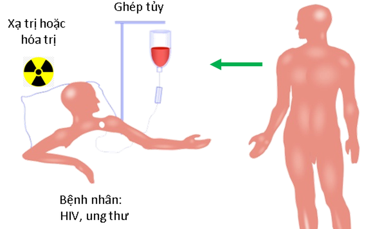 Chữa hết HIV nhờ người đột biến gen