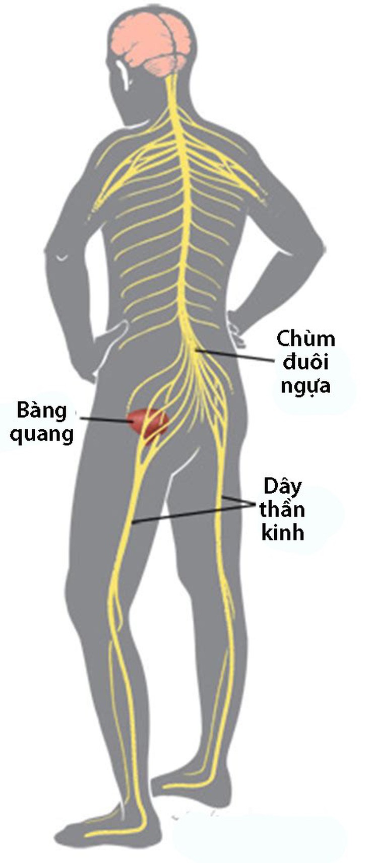 Hội chứng chùm đuôi ngựa - Ảnh 1.