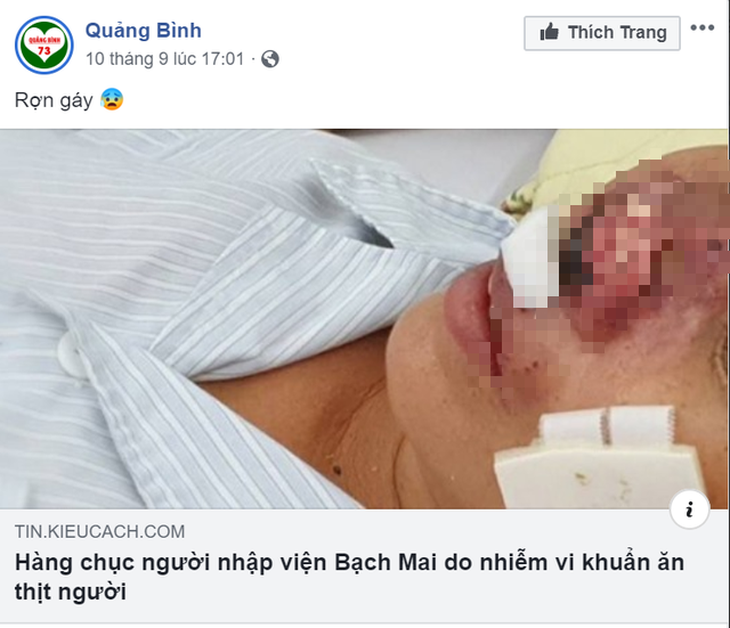 Quảng Bình bác tin đồn có bệnh nhân nhiễm vi khuẩn ăn thịt người Whitmore - Ảnh 1.