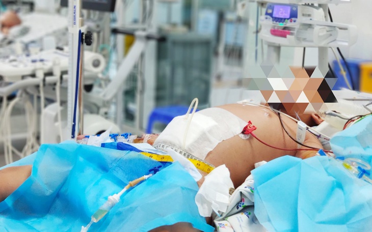 Cứu bé trai 9 tuổi bị sốc sốt xuất huyết nặng, tổn thương nhiều cơ quan